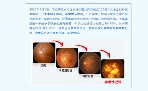 孩子近视可以精准控制？一次免费体验机会